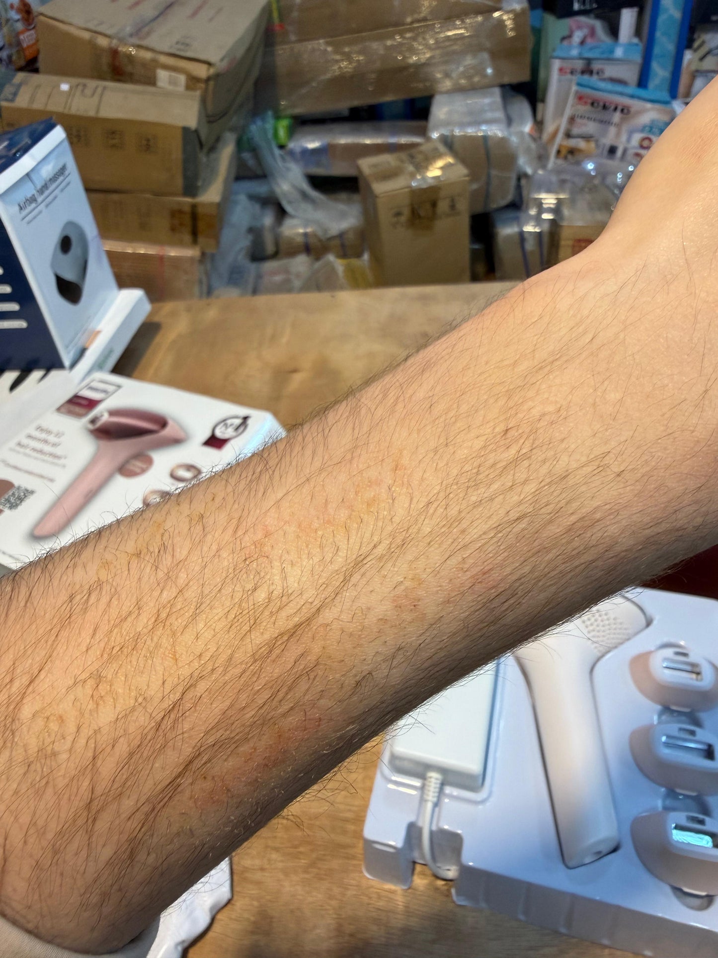 Philips IPL Hair Removal 9900