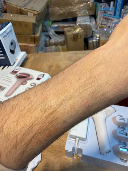 Philips IPL Hair Removal 9900